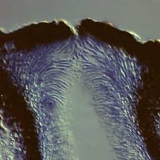 Attēlu rezultāti vaicājumam “Diatrype disciformis”