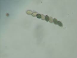 Attēlu rezultāti vaicājumam “Sordaria fimicola”