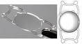 Corneal, cataract and Laser Eye Surgery Specialists, London and