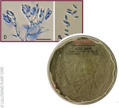 Attēlu rezultāti vaicājumam “Craterium minutum cf. var. brunneum spores”
