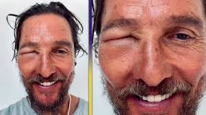 Image result for Bugaboo Bee Matthew McConaughey