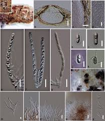 Attēlu rezultāti vaicājumam “Rosellinia desmazieri spores”