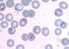 Attēlu rezultāti vaicājumam “Enteridium variabile plasmodium”