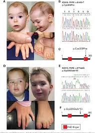 Attēlu rezultāti vaicājumam “Heterotrichia oerstedii (syn. Arcyria oerstedii) young”