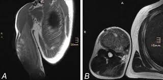 Image result for SYNTHOL