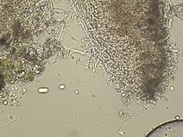 Attēlu rezultāti vaicājumam “Corticium roseum”