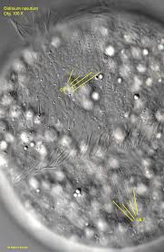 Attēlu rezultāti vaicājumam “Diderma subincarnatum sessile”