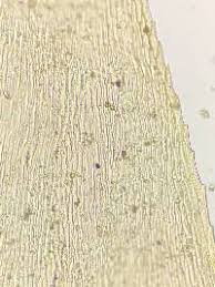 Attēlu rezultāti vaicājumam “Thamnobryum subserratum”