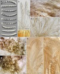 Attēlu rezultāti vaicājumam “Nardia scalaris cells”