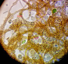 Attēlu rezultāti vaicājumam “Cribraria costata spores”