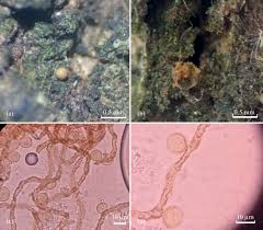Attēlu rezultāti vaicājumam “Perichaena corticalis spores”