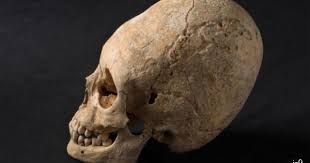 Image result for elongated skulls
