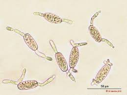Attēlu rezultāti vaicājumam “Sarcoscypha austriaca var. lutea”