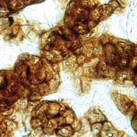 Attēlu rezultāti vaicājumam “Lycogala convexum”