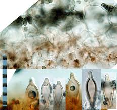 Attēlu rezultāti vaicājumam “Comatricha elegans spores”