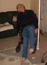 dystonia