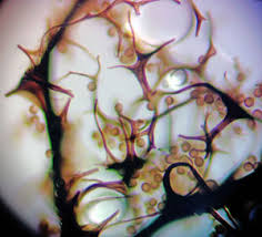 Attēlu rezultāti vaicājumam “Stemonaria irregularis”