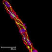 Blood–brain barrier - Wikipedia, the free encyclopedia