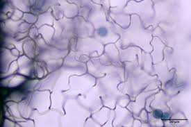 Attēlu rezultāti vaicājumam “Comatricha pulchella stalked”