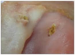 Attēlu rezultāti vaicājumam “Somateria mollissima juvenile”