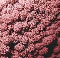 Attēlu rezultāti vaicājumam “Heterotrichia ferruginea (syn. Arcyria ferruginea)”