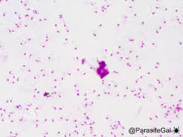 Attēlu rezultāti vaicājumam “Reticularia lobata plasmodium”