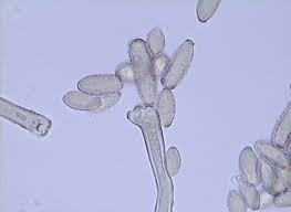 Attēlu rezultāti vaicājumam “Coleosporium sp.”