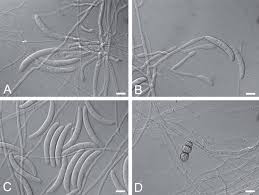 Attēlu rezultāti vaicājumam “Nectria sp., Neonectria sp.”