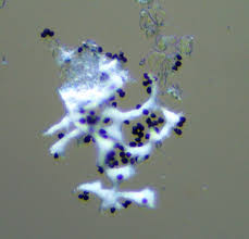 Attēlu rezultāti vaicājumam “Badhamia melanospora”