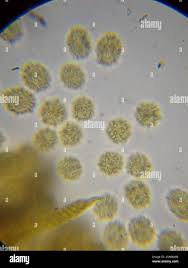 Attēlu rezultāti vaicājumam “Oligonema persimile spores”