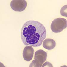 Attēlu rezultāti vaicājumam “Diderma cingulatum plasmodium”