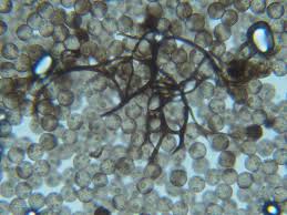 Attēlu rezultāti vaicājumam “Comatricha pulchella”