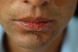 http://t0.gstatic.com/images?q=tbn:ANd9GcS7MPuUXvV5I5eAH1gyoGiJ-io3hmKcVZ-WZ49nwtdzjw8A0_0&t=1&usg=__y8tPlHIrKFUYwLB3Lk1uQtXArvA=