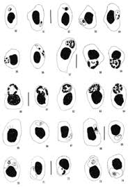 Attēlu rezultāti vaicājumam “Lignydium muscorum plasmodium”