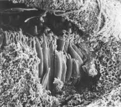 Attēlu rezultāti vaicājumam “Melanospora lagenaria”