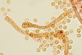 Attēlu rezultāti vaicājumam “Lycogala sp.”