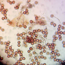 Attēlu rezultāti vaicājumam “Diderma testaceum young”
