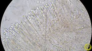 Attēlu rezultāti vaicājumam “Ombrophila violacea”