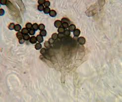 Attēlu rezultāti vaicājumam “Lichenoconium xanthoriae”