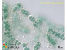 Attēlu rezultāti vaicājumam “Nostoc pruniforme cells”