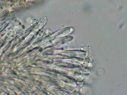 Attēlu rezultāti vaicājumam “Hyalorbilia inflatula”