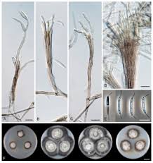 Attēlu rezultāti vaicājumam “Stemonitopsis aequalis var. microspora spores”