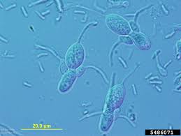 Attēlu rezultāti vaicājumam “Stemonitopsis aequalis var. microspora stalked”