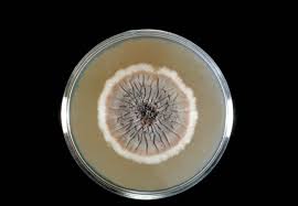 Attēlu rezultāti vaicājumam “Badhamia affinis spores”