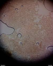 Attēlu rezultāti vaicājumam “Lycogala paraconfusum sessile”