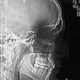 HowStuffWorks "How CAT Scans Work"
