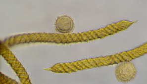 Attēlu rezultāti vaicājumam “Oligonema persimile”