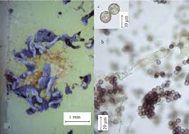 Attēlu rezultāti vaicājumam “Licea testudinacea spores”