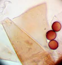 Attēlu rezultāti vaicājumam “Fuligo leviderma spores”