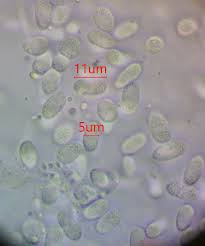 Attēlu rezultāti vaicājumam “Physarum pseudoalexandrowiczii spores”